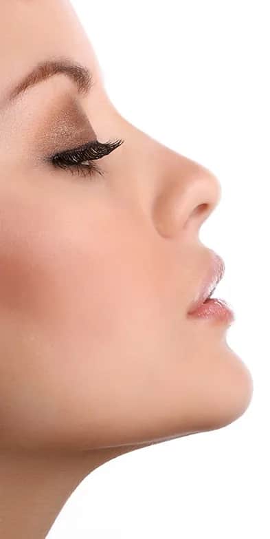 Rhinoplasty bridge: side porfile of a young woman