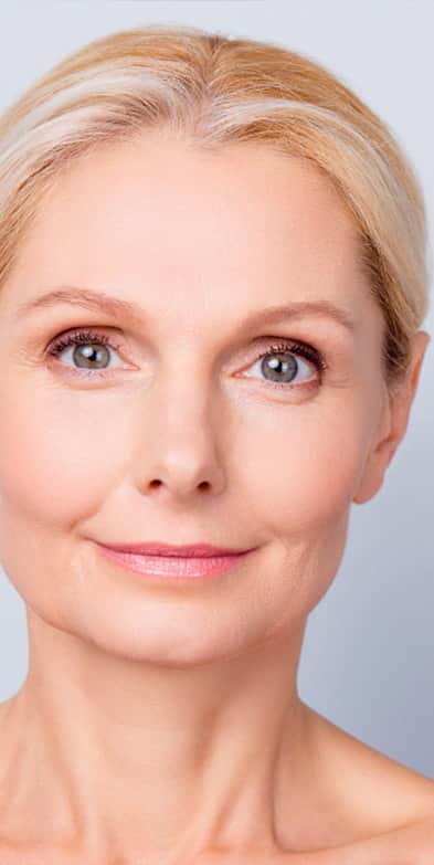 Liquid Facelift: Older woman with mild signs of aging looking at the camera