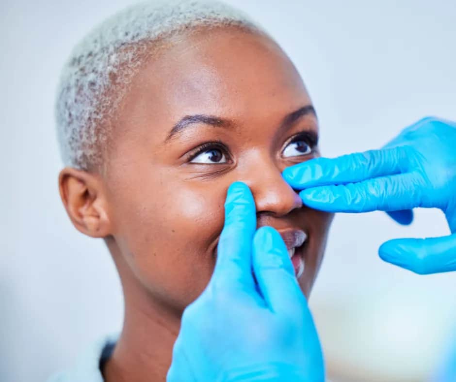 Ethnic Rhinoplasty: Black female recovery follow-up consultation
