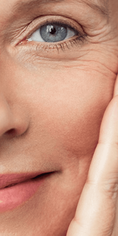 Facial Nerve Paralysis: Close-up od older woman smiling at the camera