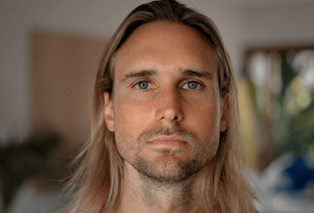 Neck liposuction Image Left