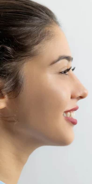 Septoplasty Dallas: Side profile of a young woman smiling